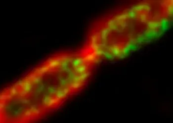 New compound that kills antibiotic-resistant superbugs discovered