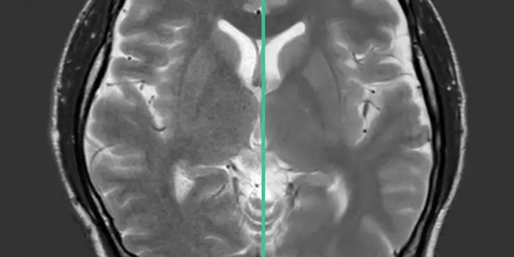 Fujifilm Releases New System Software