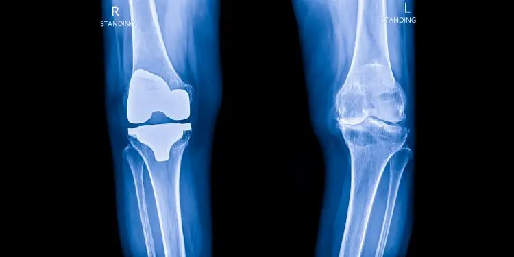 AfterCare: Under The Knife